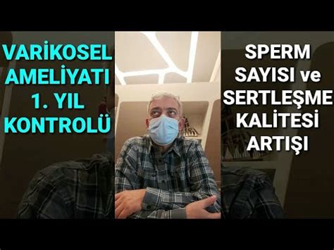 Filtre bakımı sonrası görüntü kalitesi artışı